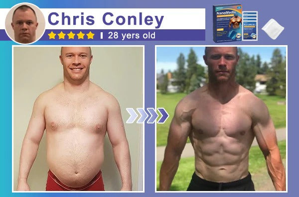 🔥Limited-time 50% sale🔥⚕️💙Slimoly®️ Gynecomastia Chest Fatburn & Firm Patch