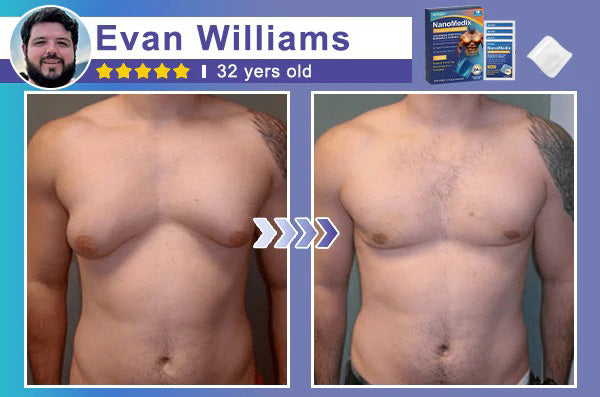 🔥Limited-time 50% sale🔥⚕️💙Slimoly®️ Gynecomastia Chest Fatburn & Firm Patch